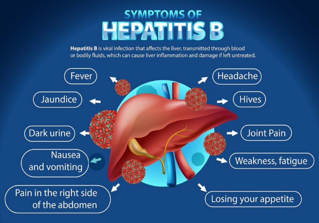 Hepatitis B